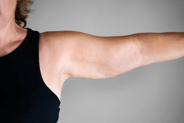 Arm Skin Tightening